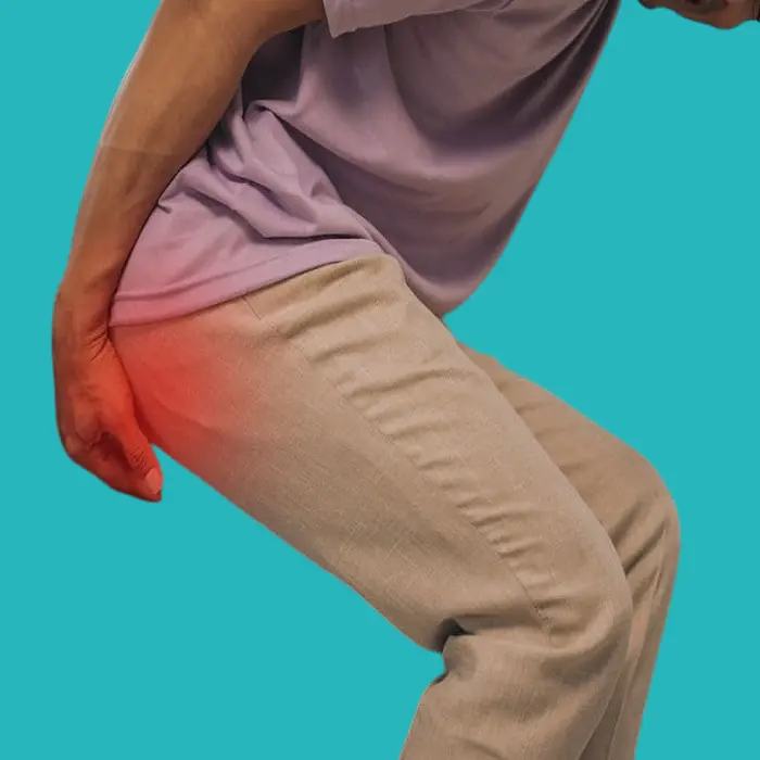 what is the difference between a pilonidal sinus and an anal fistula? 