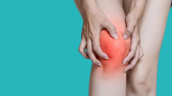 arthritis