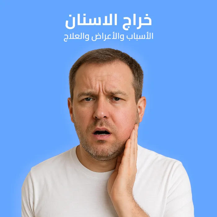 tooth abscess: causes, symptoms, and treatment 