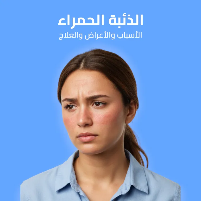 الذئبة الحمراء: الأسباب والأعراض والعلاج 