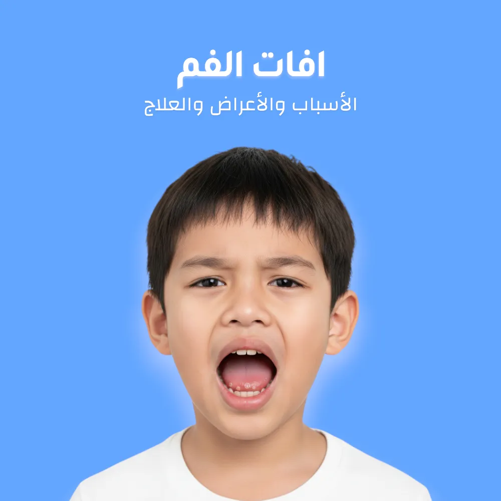 افات الفم: الأسباب والأعراض والعلاج 