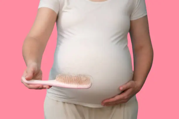 اسباب تساقط الشعر اثناء الحمل