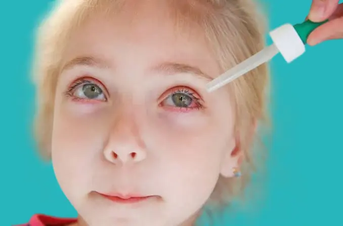 Treatment of recurrent red eyes in children