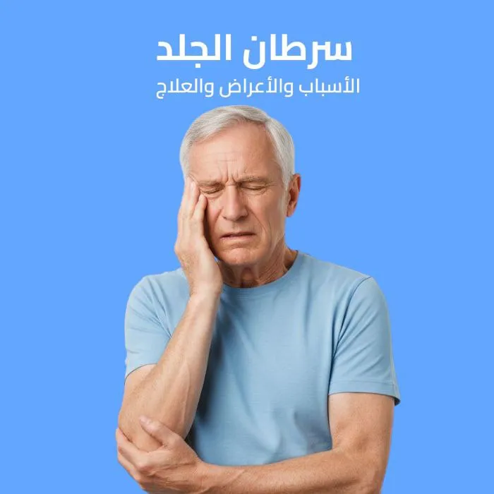 melanoma: causes, symptoms, and treatment 