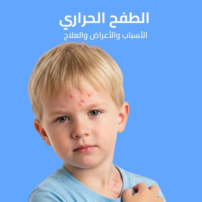 heat rash: causes, symptoms, and treatment 