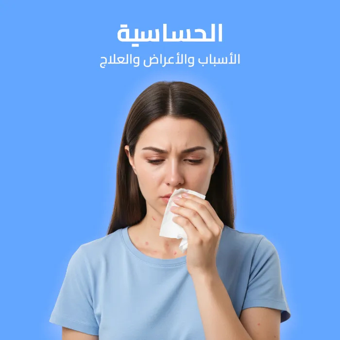 الحساسية: الأسباب والأعراض والعلاج 