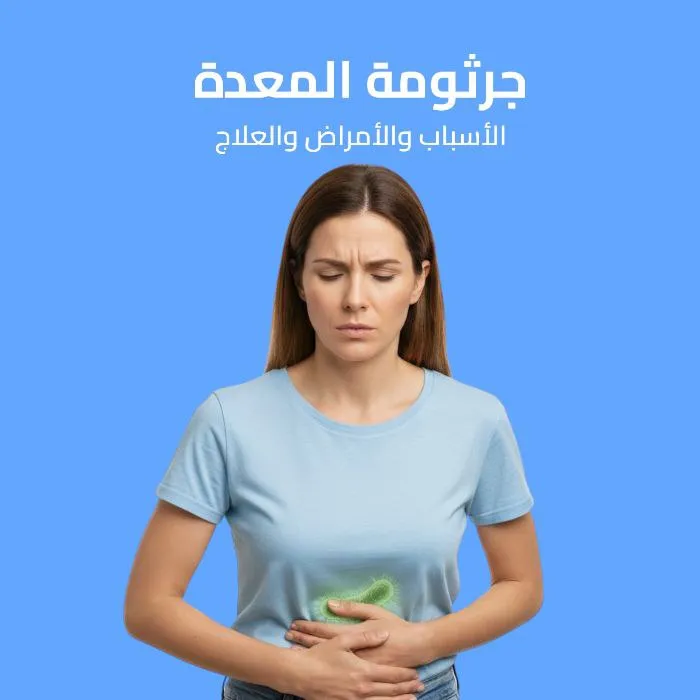 جرثومة المعدة: الأسباب والأعراض والعلاج 