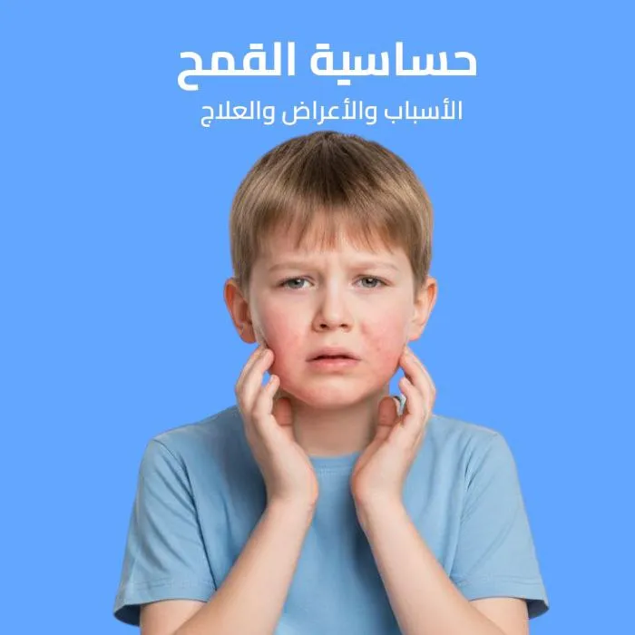 wheat allergy: causes, symptoms, and treatment 