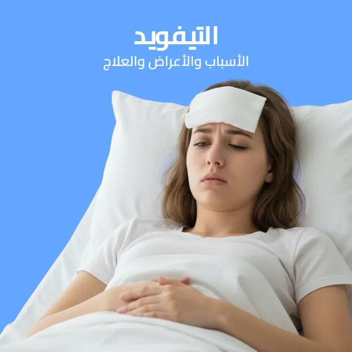 التيفويد: الأسباب والأعراض والعلاج 