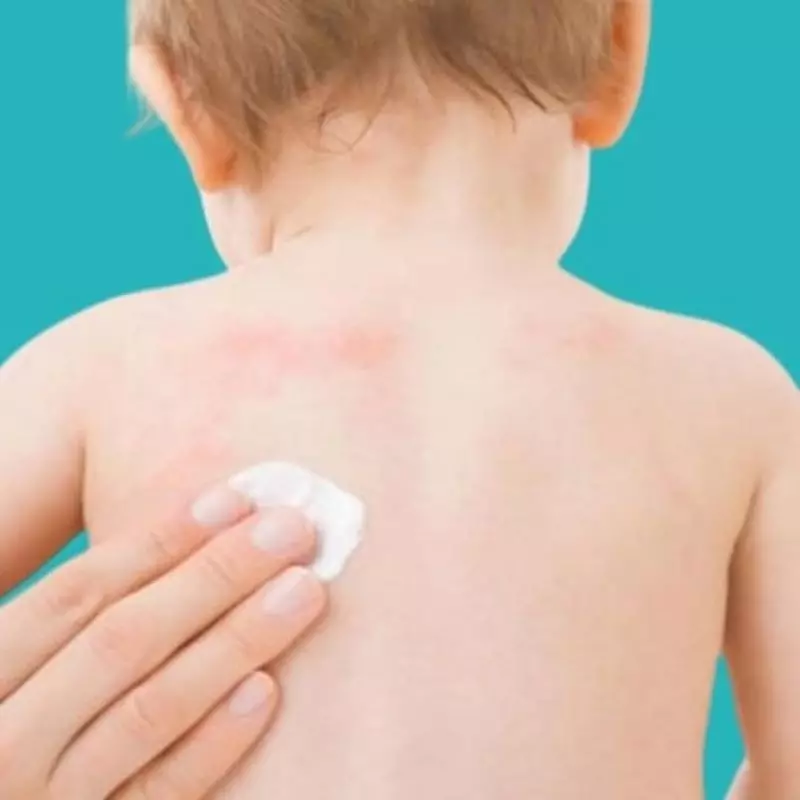 Tips for preventing skin infections in children 
