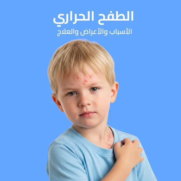 heat rash: causes, symptoms, and treatment 