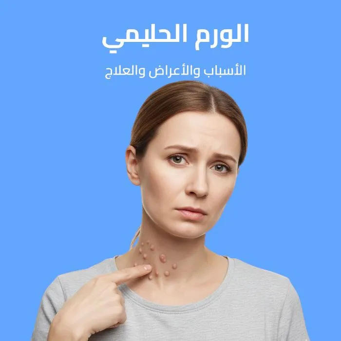 الورم الحليمي: الأسباب والأعراض والعلاج 