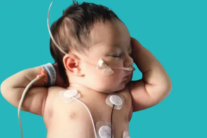 Causes of congenital heart defects in children