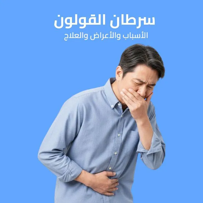 سرطان القولون: الأسباب والأعراض والعلاج 